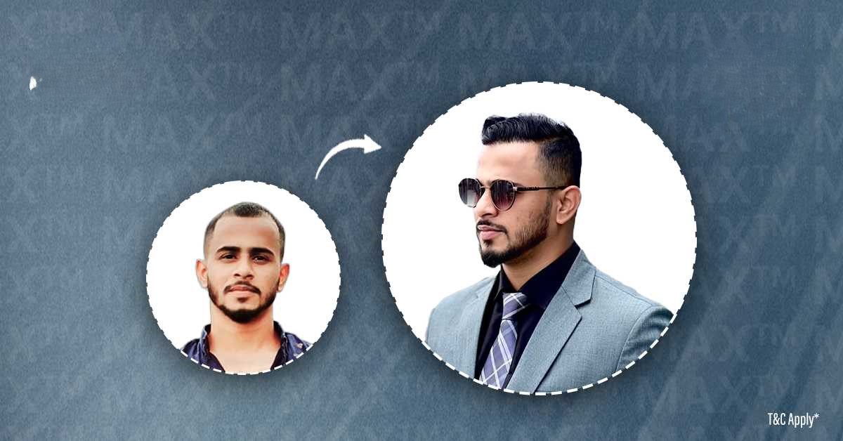 MAX Hair Transplant Clinic in Hyderabad - Best Hair Transplant Services